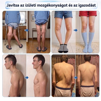 𝐎𝐫𝐯𝐨𝐬𝐢 𝐬𝐳𝐚𝐤𝐞́𝐫𝐭𝐨̋𝐤 𝐚́𝐥𝐭𝐚𝐥 𝐤𝐢𝐟𝐞𝐣𝐥𝐞𝐬𝐳𝐭𝐯𝐞👨‍⚕️| 𝑿𝑹𝑳𝑿𝑹𝑳® 0,05 mm-es mikrotűs csont- és ízületregeneráló roll-on