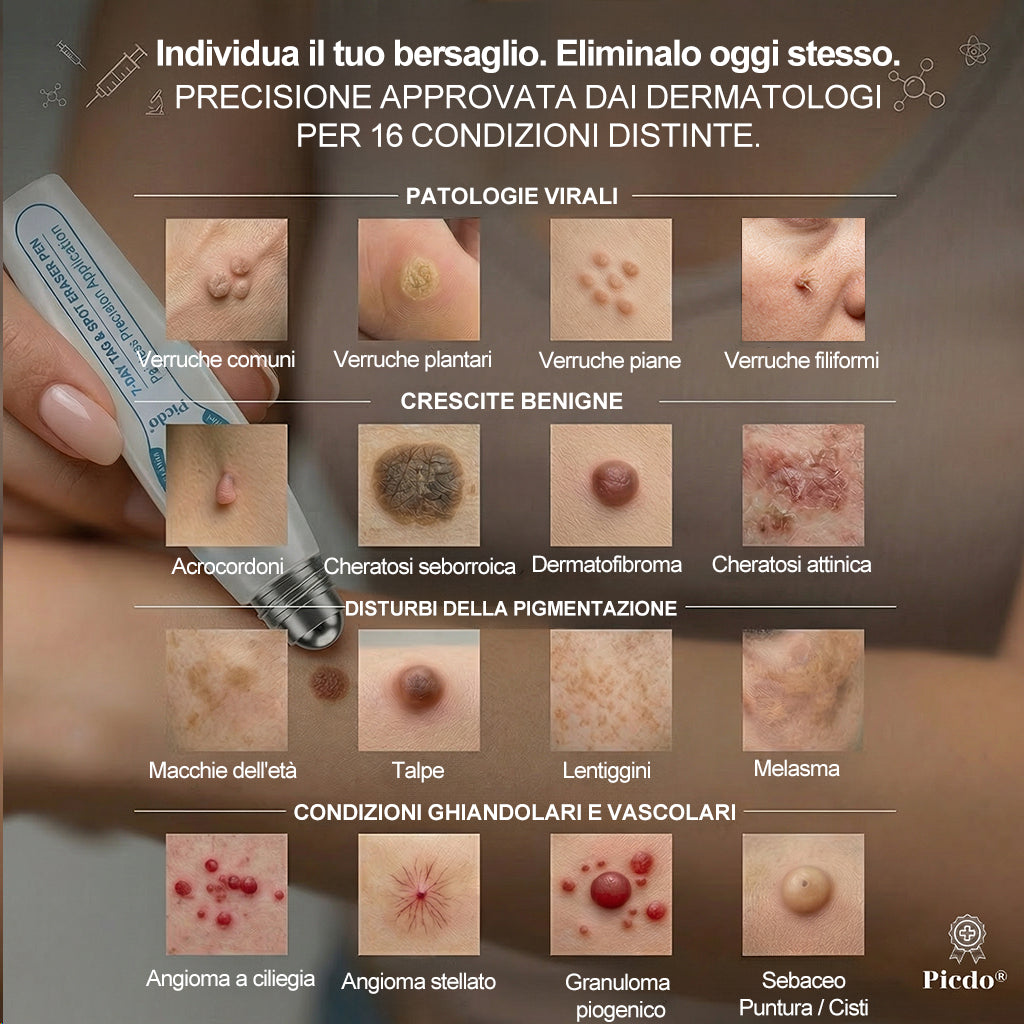 𝐏i𝐜𝐝o® 🔊 Soluzione mirata di 7 giorni per la cura degli acrocordoni e delle imperfezioni cutanee (Applicazione indolore con roll-on, senza lasciare segni)