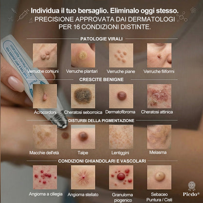 𝐏i𝐜𝐝o® 🔊 Soluzione mirata di 7 giorni per la cura degli acrocordoni e delle imperfezioni cutanee (Applicazione indolore con roll-on, senza lasciare segni)